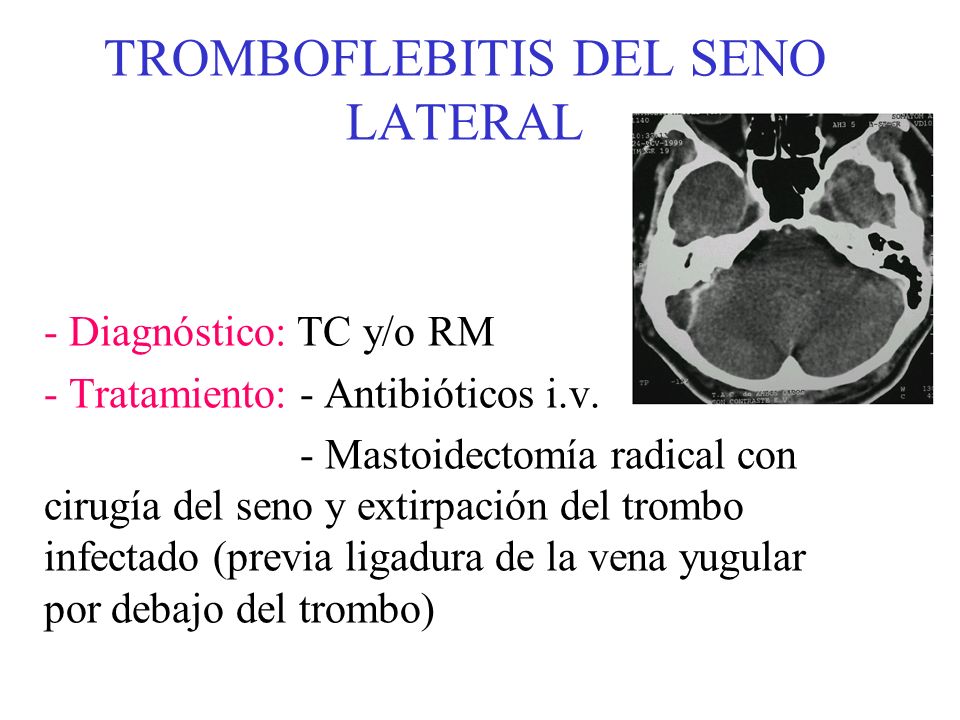 Las trombosis de las venas y las arterias de las extremidades inferiores